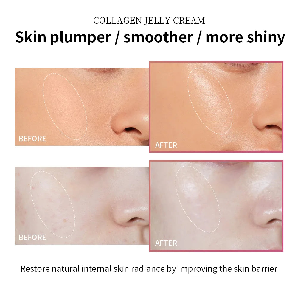 Collagen Jelly Moisturizing Cream – Niacinamide Firming & Hydrating Gel